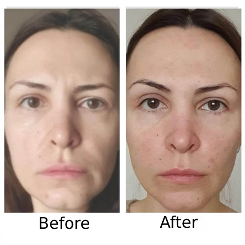 Before and After