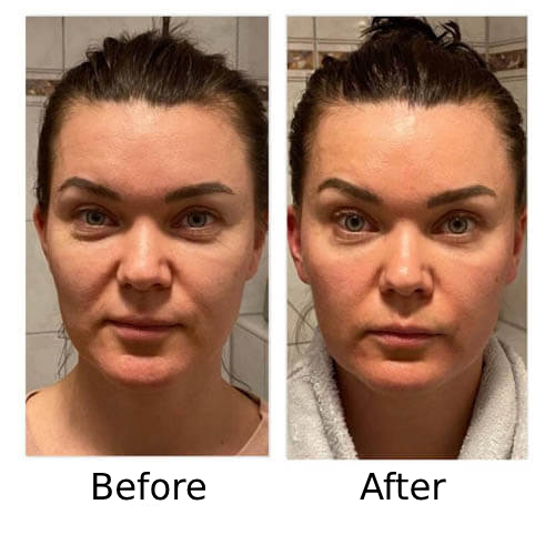 Before and After